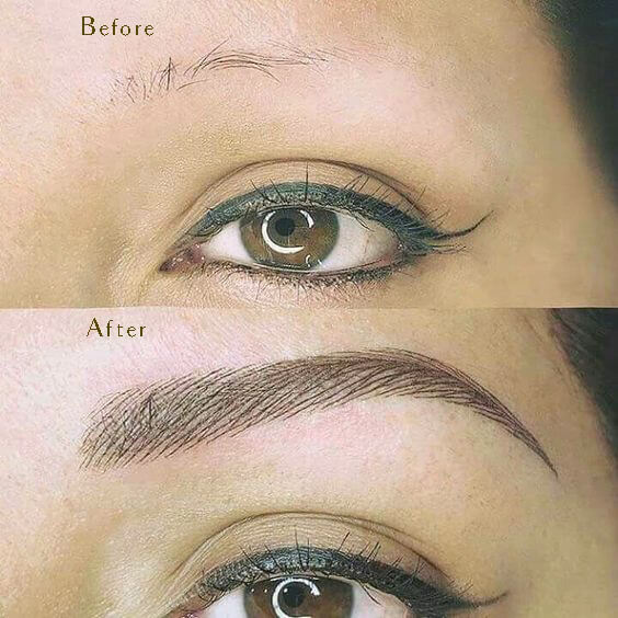 Brow Before & After